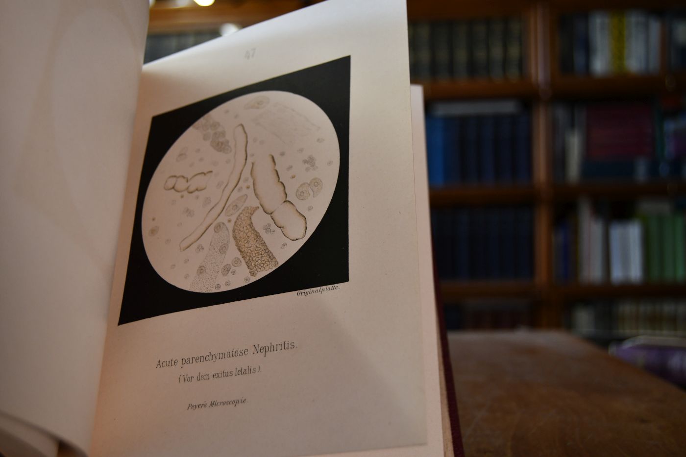 Atlas der Mikroskopie am Krankenbette.